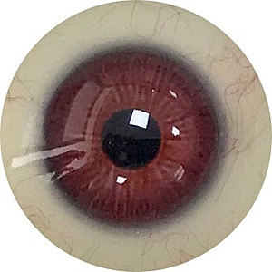 Rot